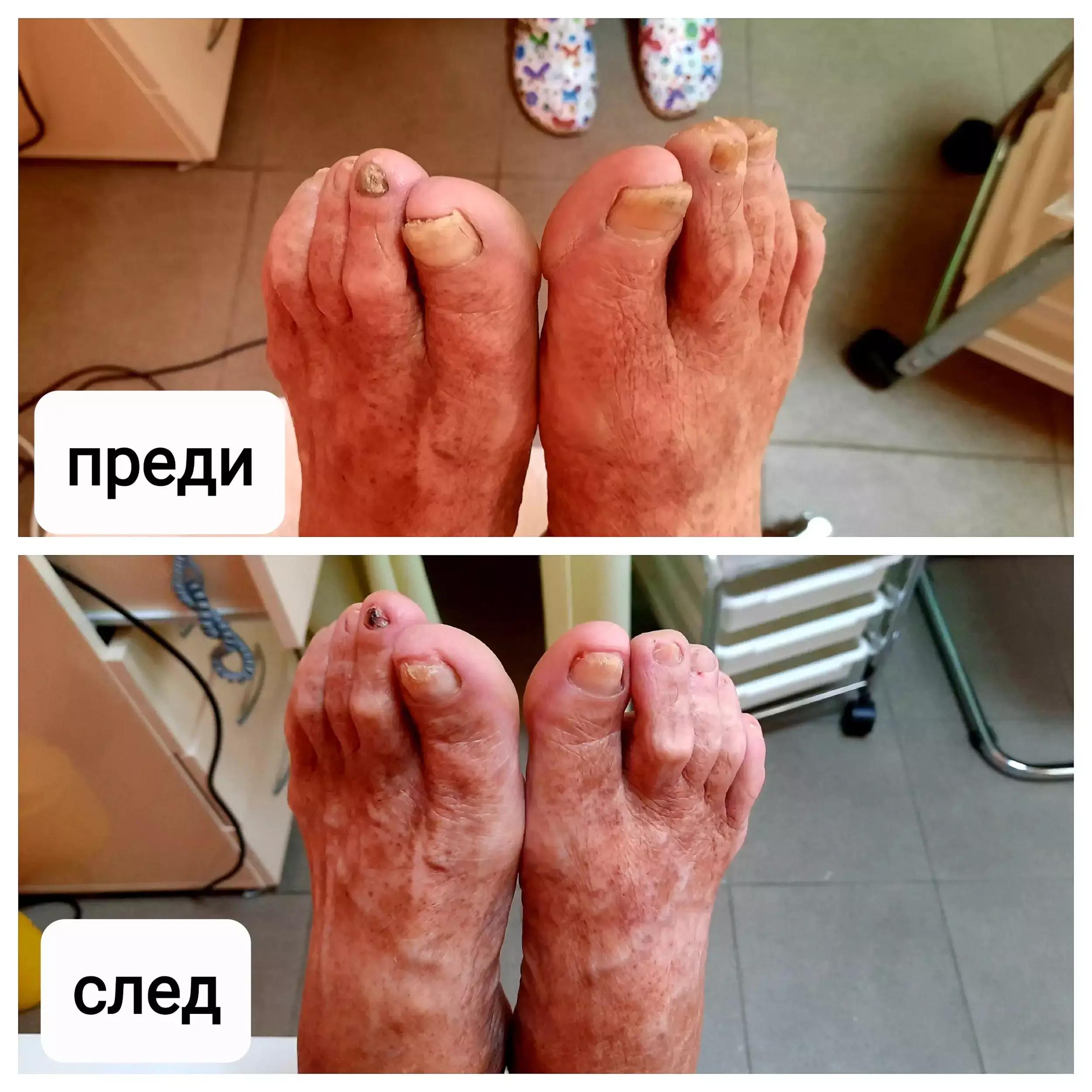 Медицински педикюр в Силистра https://www.facebook.com/medpedicur/