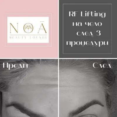 NOA Beauty Lounge