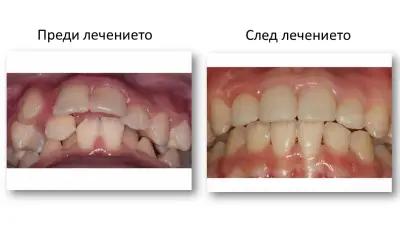 SmileArt Ортодонтска практика Варна