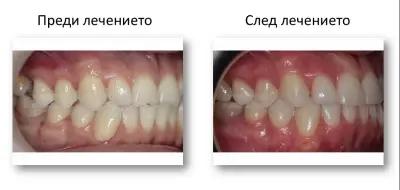 SmileArt Ортодонтска практика Варна