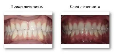 SmileArt Ортодонтска практика Варна