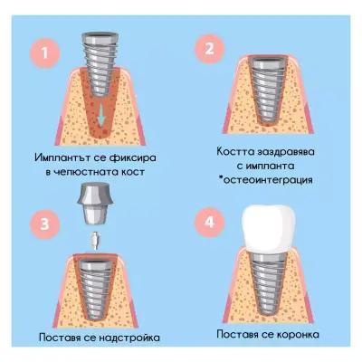 Стоматологичен кабинет Габрово “Rocket”/ Dental cabinet Gabrovo