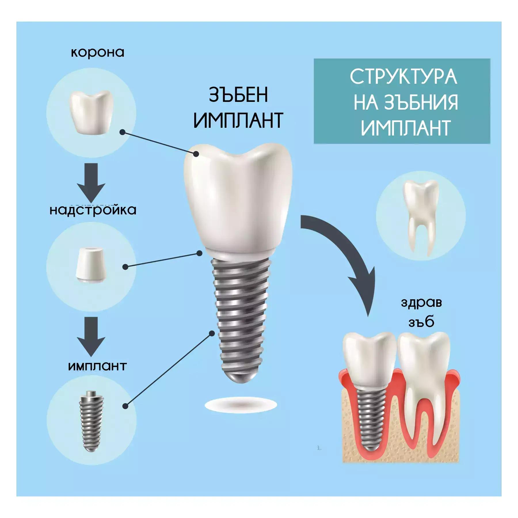 Стоматологичен кабинет Габрово “Rocket”/ Dental cabinet Gabrovo