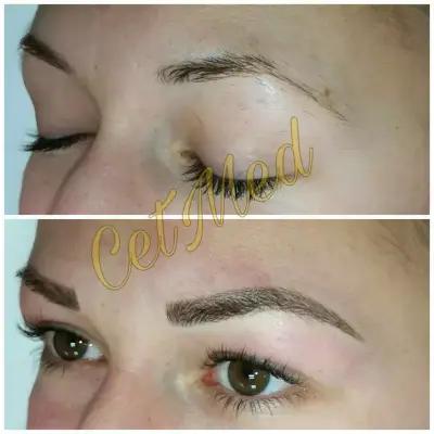 ЦитМед център Пловдив CetMed (микроблейдинг microblading)