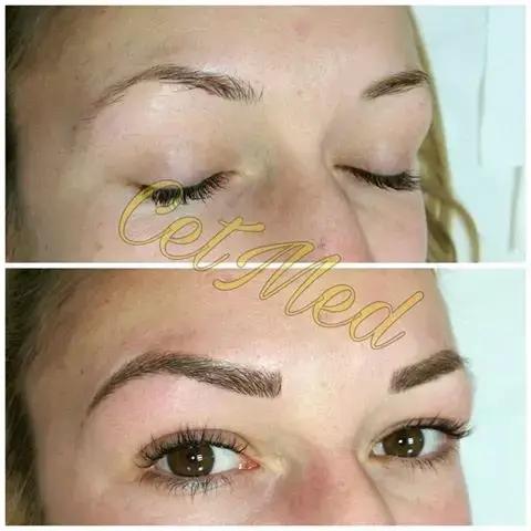 ЦитМед център Пловдив CetMed (микроблейдинг microblading)