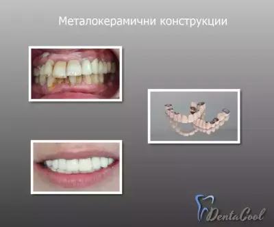 Дентална практика DentaCool д-р Калина Георгиева, д.м.