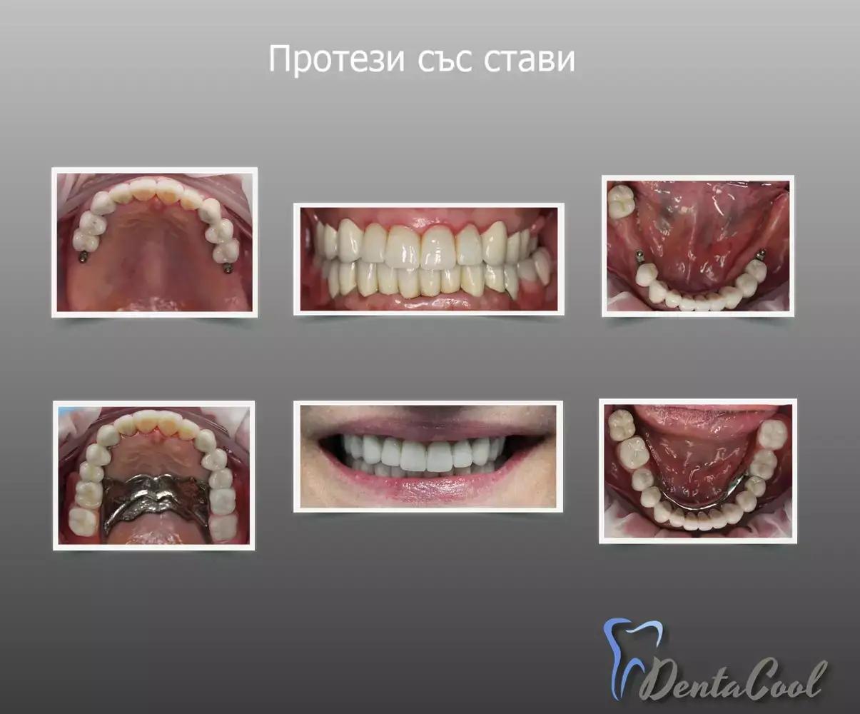 Дентална практика DentaCool д-р Калина Георгиева, д.м.