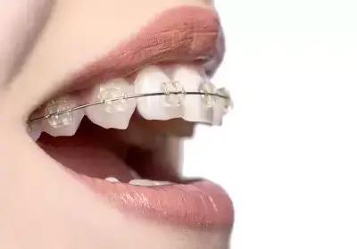 Стоматолог/Dentist /Cristal Dent др.Румяна Стоименова-ортопедия,хирургия,имплантология,фасети,корони,протези,мостове и