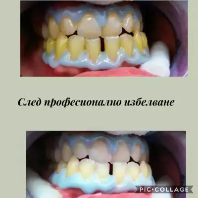 Зъболекар Пазарджик д-р Надежда Христова Dentist Dr. Nadezhda Hristova