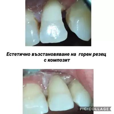 Зъболекар Пазарджик д-р Надежда Христова Dentist Dr. Nadezhda Hristova