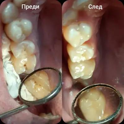 Д-р Йордан Ангелов - Дентален лекар/D-r Jordan Angelov - Dentist