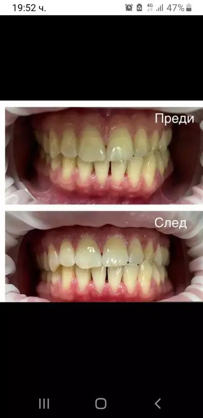 РиноДент - Стоматологичен / Зъболекарски кабинет -Стара Загора