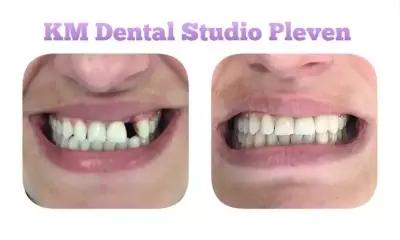 KM Dental Studio Pleven