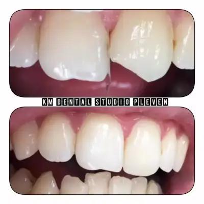 KM Dental Studio Pleven