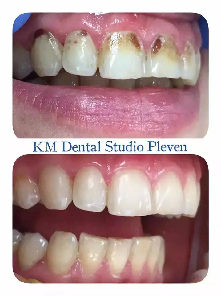 KM Dental Studio Pleven