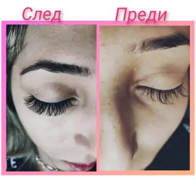 Миглопластика * Beauty Lashes