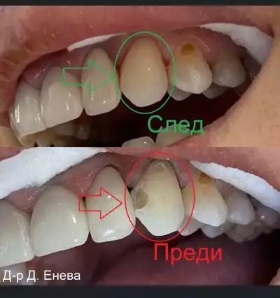 Зъболекарски кабинет Д-р Дорис Енева