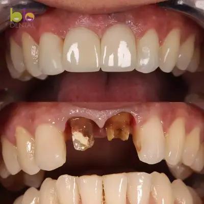 BB DENTAL CLINIC - Зъболекар в София