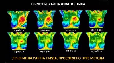 Термовизуална Диагностика - д-р Маринов