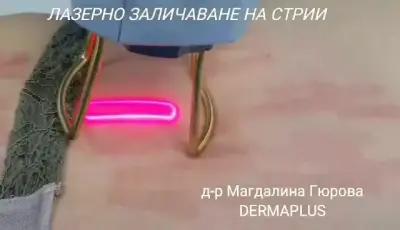 Клиника по естетична дерматология и лазерна терапия в Пловдив - DermaPlus.BG