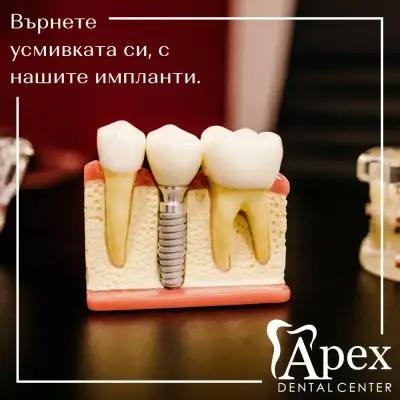 Apex Dental Center