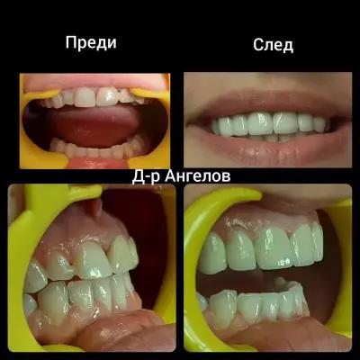 Д-р Йордан Ангелов - Дентален лекар/D-r Jordan Angelov - Dentist