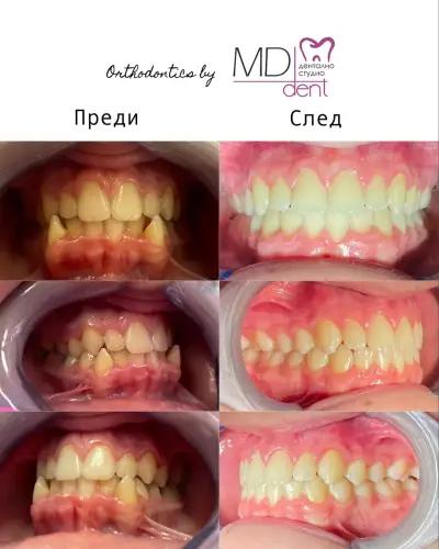 Dental Studio MD Dent Ltd Dupnitsa / Дентално студио МД Дент ООД гр. Дупница