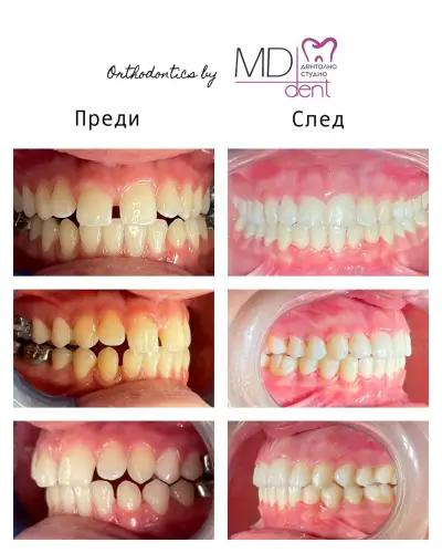 Dental Studio MD Dent Ltd Dupnitsa / Дентално студио МД Дент ООД гр. Дупница