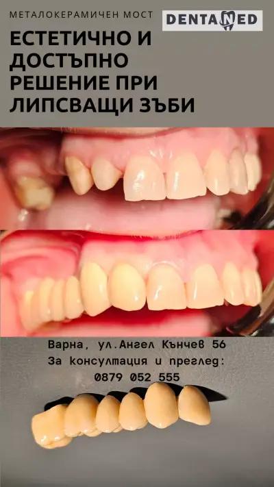 DentaNed д-р Стелиян Недев стоматолог/Dentist Varna/.