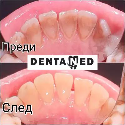 DentaNed д-р Стелиян Недев стоматолог/Dentist Varna/.