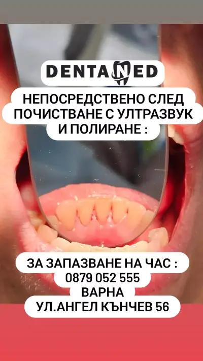 DentaNed д-р Стелиян Недев стоматолог/Dentist Varna/.