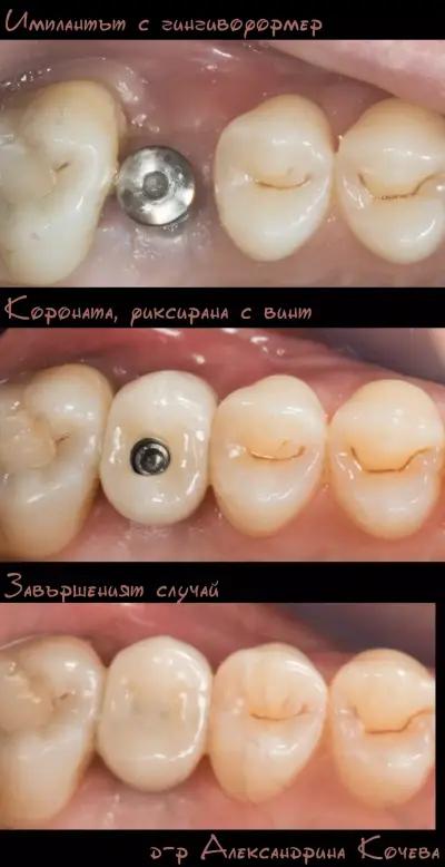 Д-р Александрина Кочева - Зъболекар